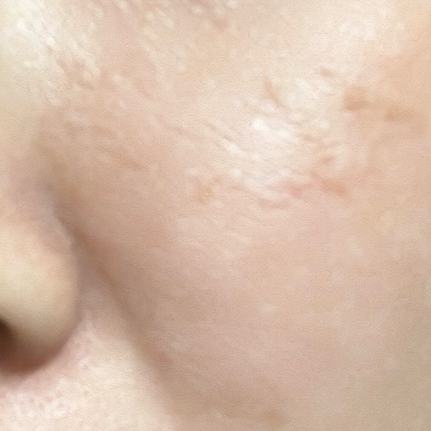 トリプル レチノール ウォッシュピール/Celladix/ピーリングを使ったクチコミ（3枚目）