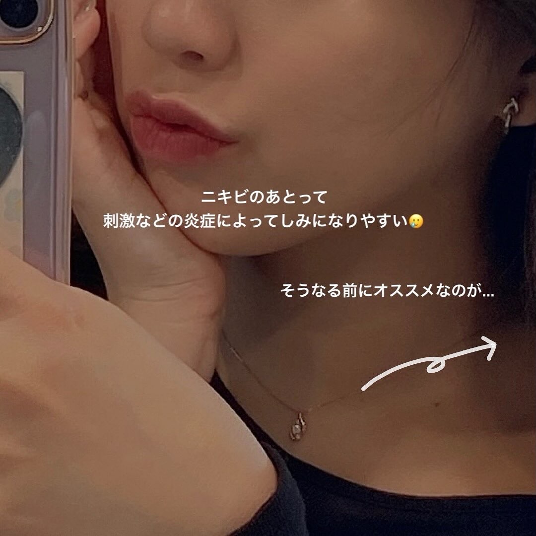 ニキビあとケアジェル/アットノン/その他スキンケアを使ったクチコミ（2枚目）