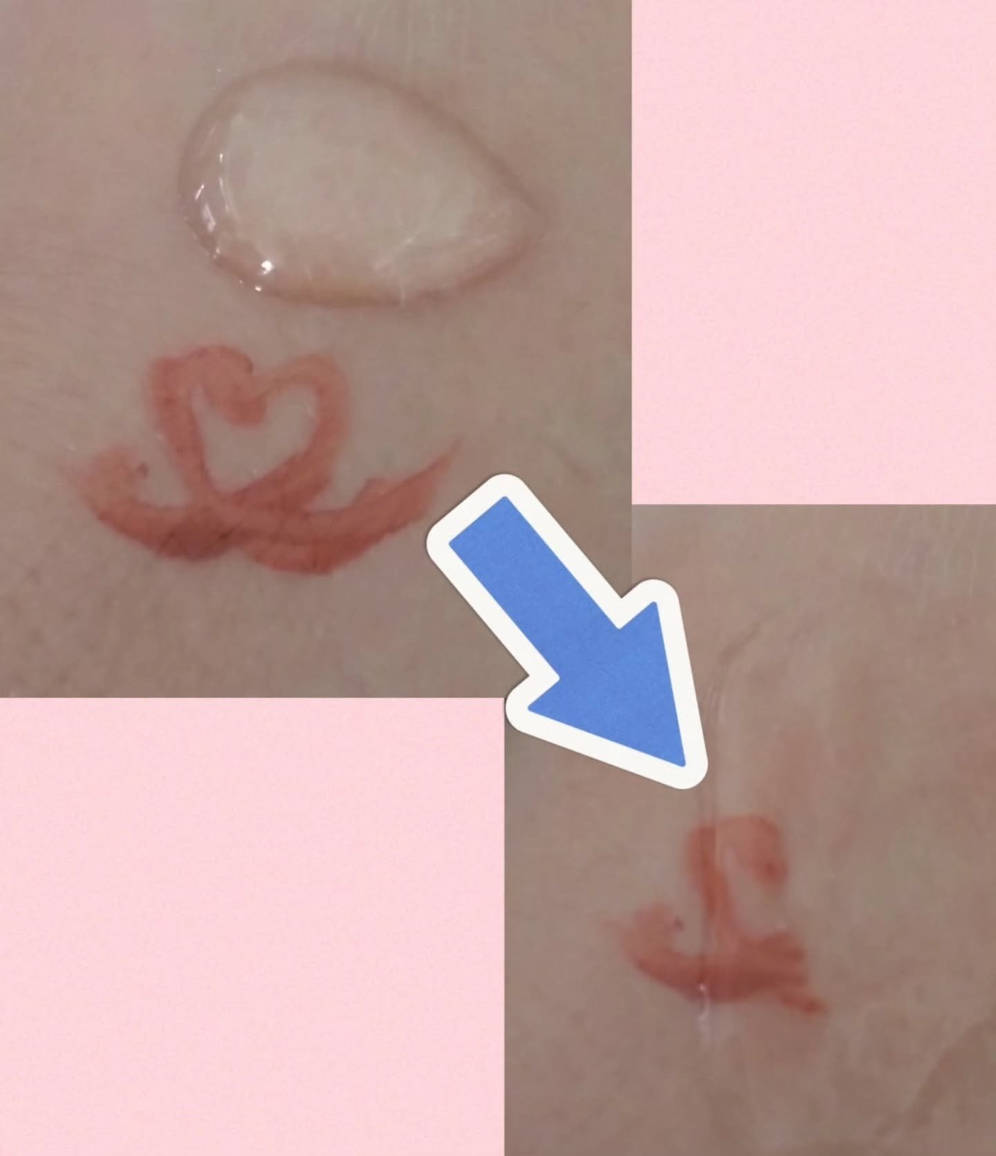 クッションジェルクレンジング R/アカラン/クレンジングジェルを使ったクチコミ（3枚目）