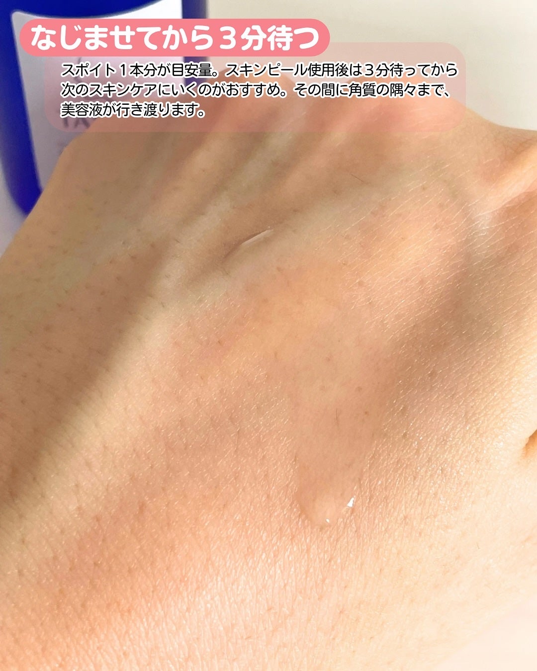 タカミスキンピール/タカミ/ブースター・導入液を使ったクチコミ(4枚目)