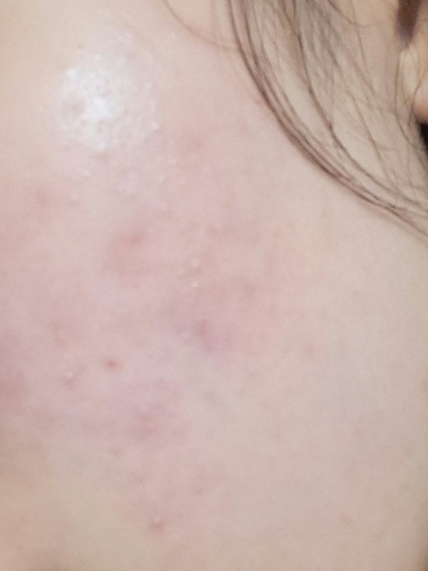 アポスティークリーム(医薬品)/アポスティー/その他を使ったクチコミ(2枚目)