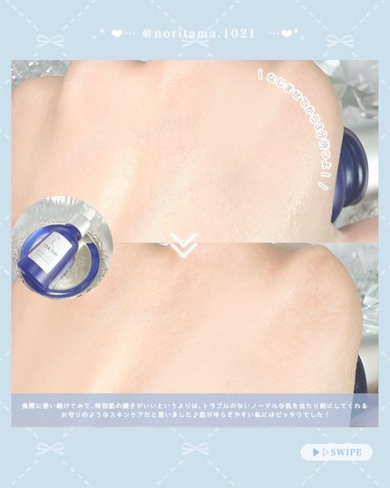 タカミスキンピール/タカミ/ブースター・導入液を使ったクチコミ(4枚目)