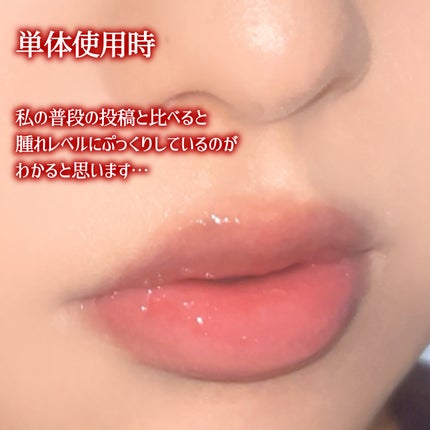 ニードルプランパー 高熱フィグ/Ui2./リッププランパーを使ったクチコミ(4枚目)