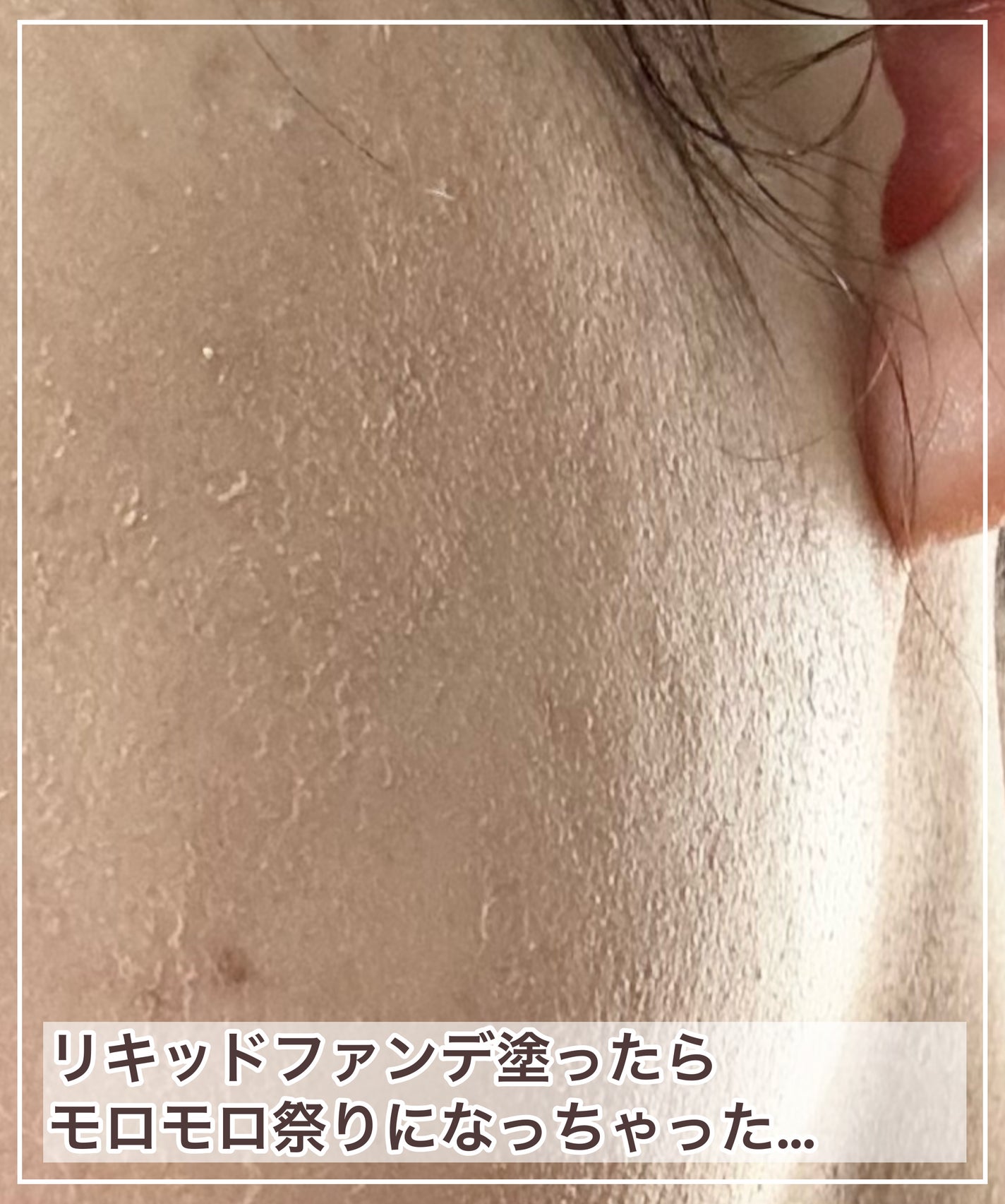 クレ・ド・ポー ボーテ エマルションプロテクトゥリス(ジュール)/クレ・ド・ポー ボーテ/乳液を使ったクチコミ(5枚目)