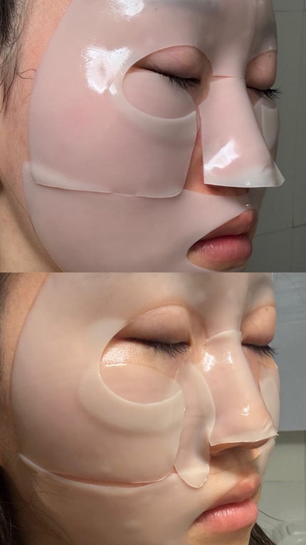 RXザ・アルファアルブチン2 ニキビ跡ケアセラム/COSRX/美容液を使ったクチコミ(5枚目)