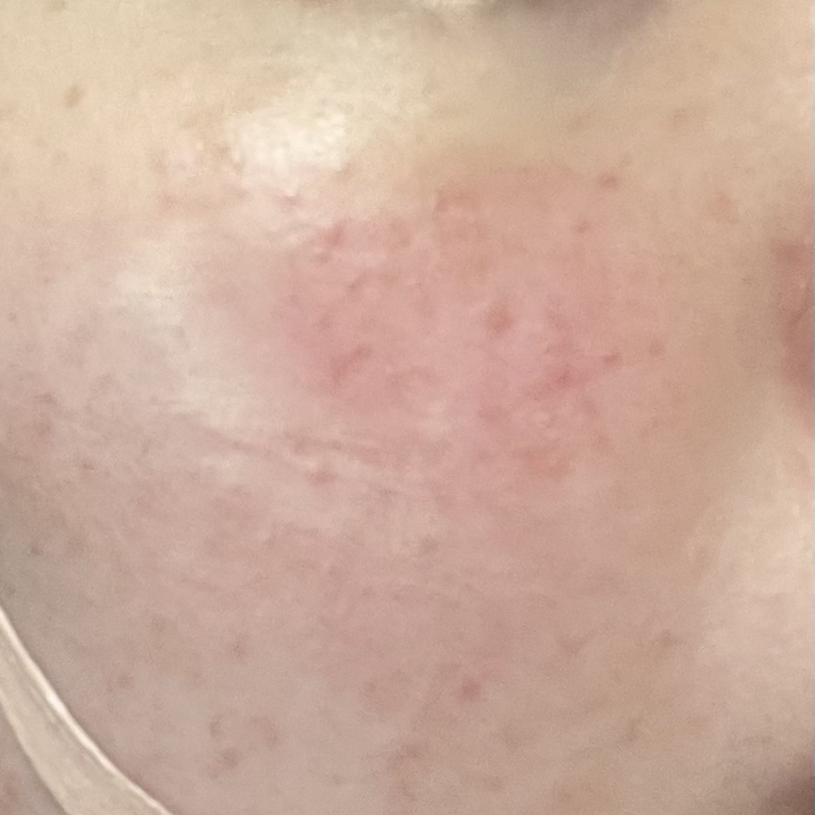 ダーマセラムミスト グルタチオン1%/SHIMBI METHOD/ミスト状化粧水を使ったクチコミ（2枚目）