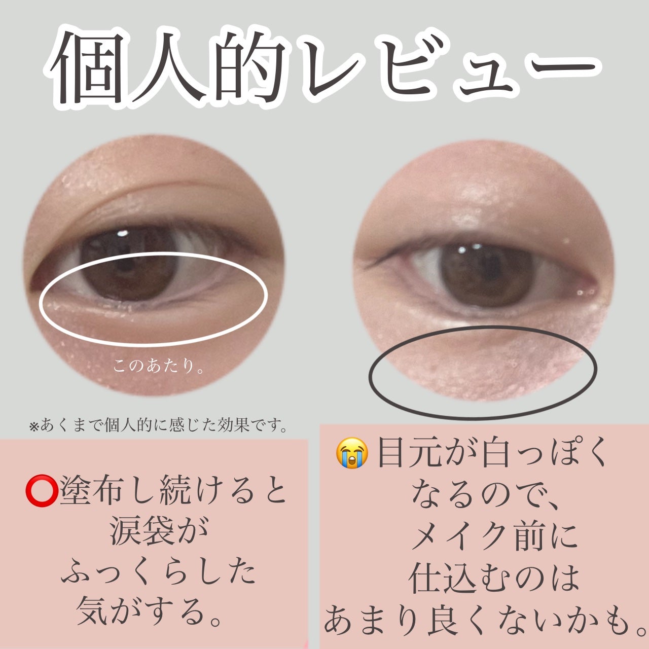 ごめんね素肌 クマらないアイクリーム/クリアターン/アイケア・アイクリームを使ったクチコミ(6枚目)