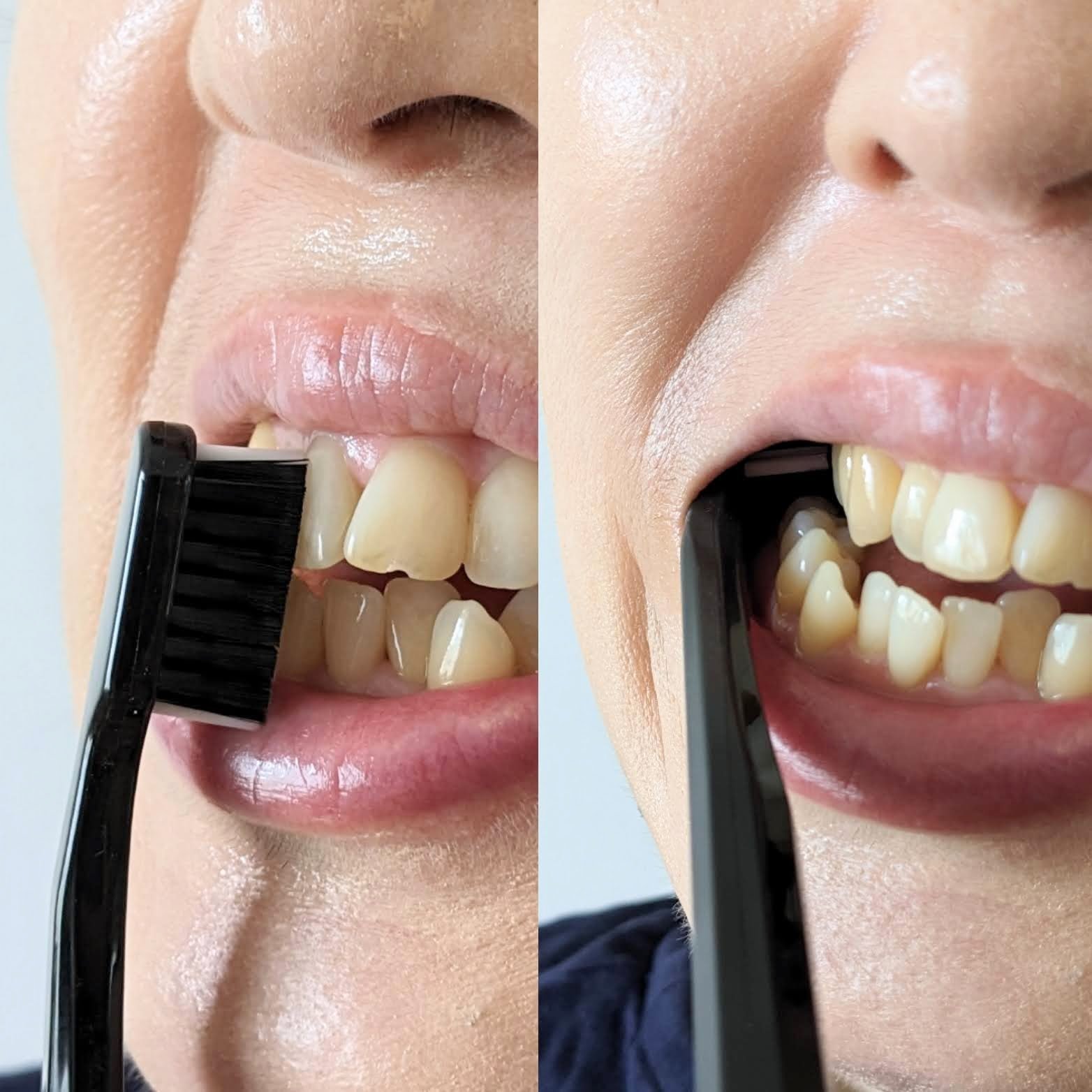 歯ブラシ ブラックisホワイト/CURAPROX/歯ブラシを使ったクチコミ（2枚目）