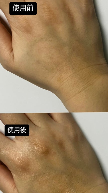 RXザ・アルファアルブチン2 ニキビ跡ケアセラム/COSRX/美容液を使ったクチコミ(2枚目)