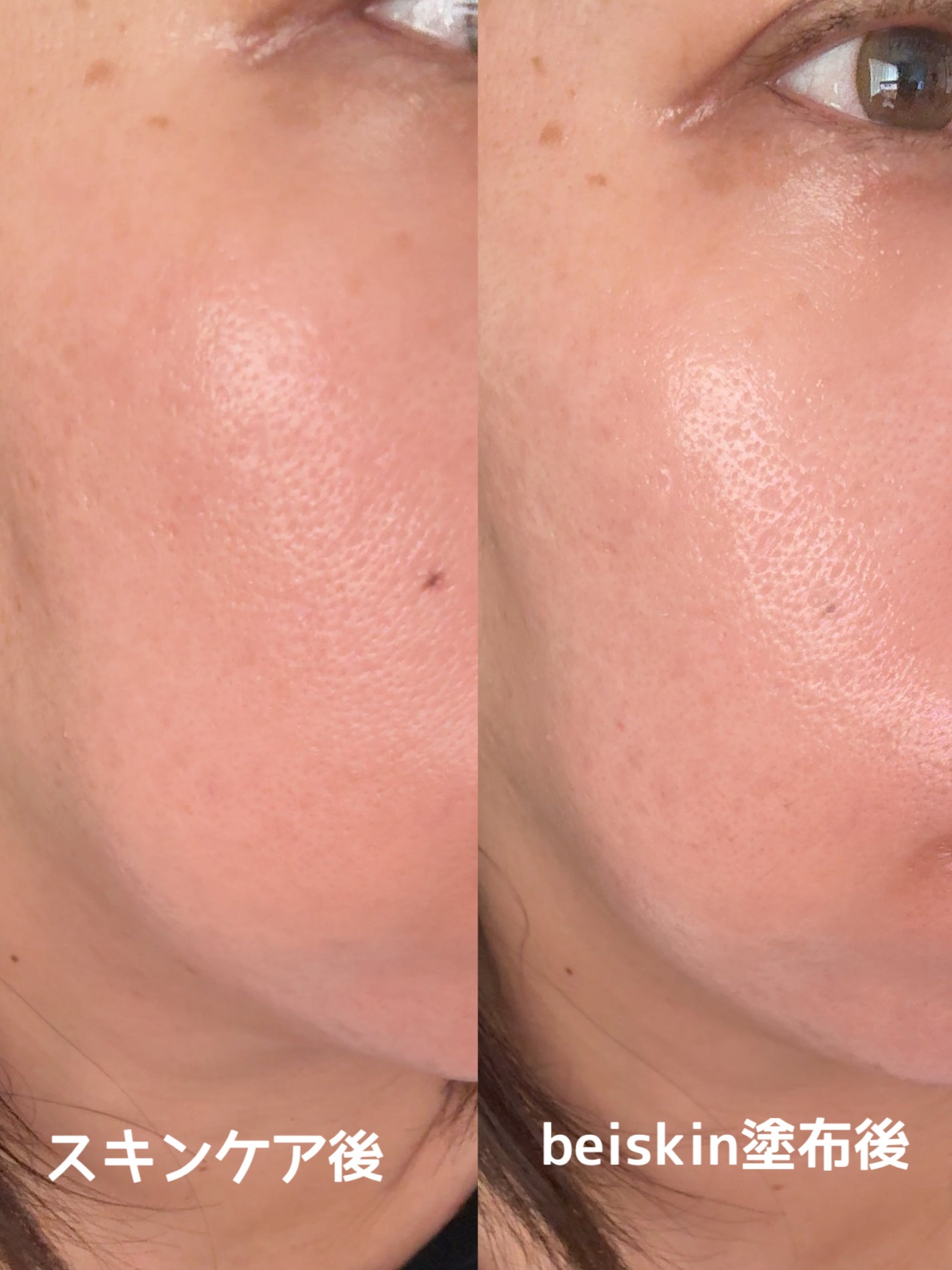 ð¶ããã¡ããð¶ on LIPS ãbeiskinãŠã©ãŒã¿ãŒãã«ãã¥ãŒã€ãµã³ã¯ãªãŒã 50mlã»æ°Žå..ãïŒ6æç®ïŒ