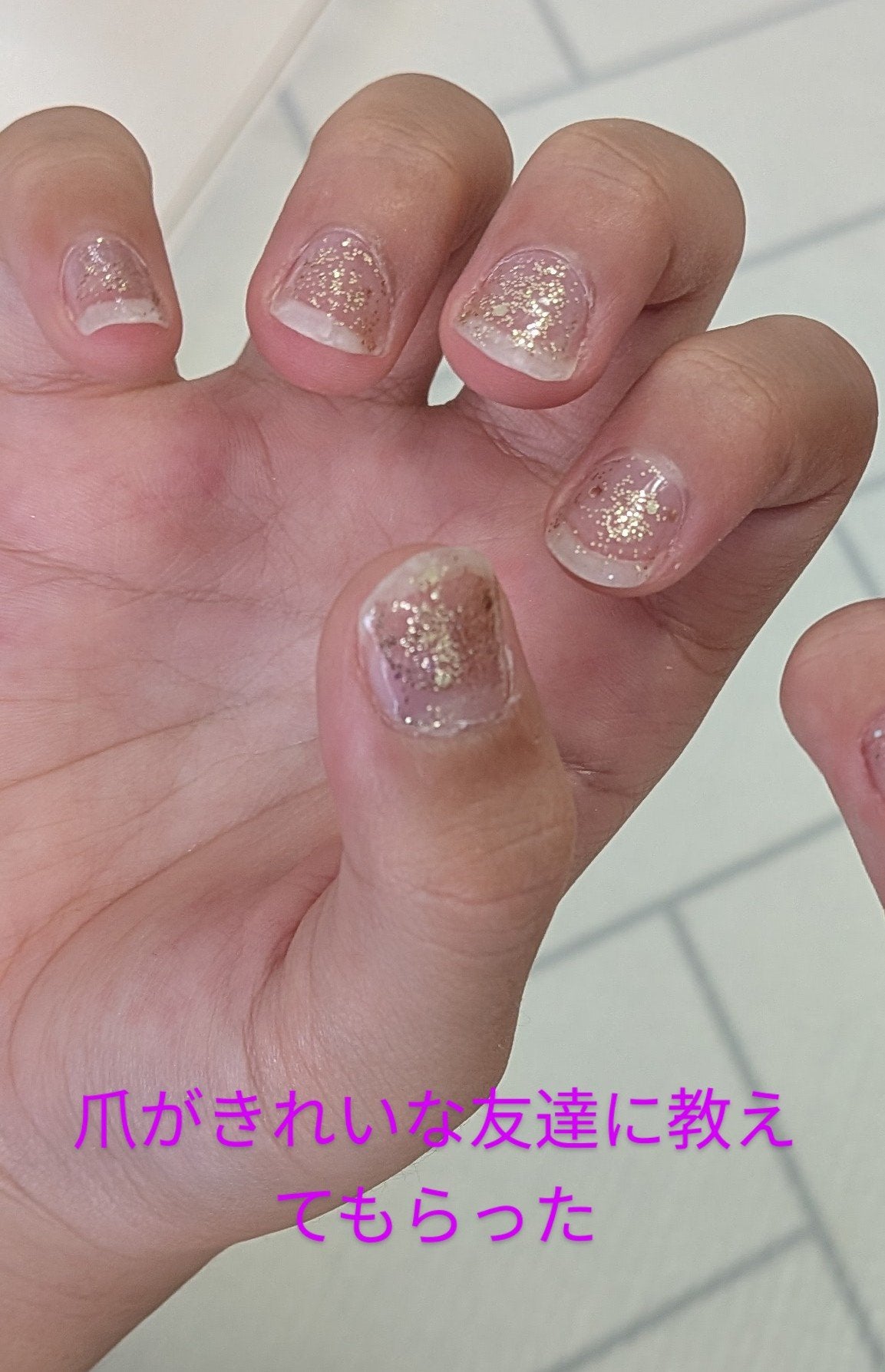 koko on LIPS 「私は昔から爪を剝く癖があるこの友達も剝く癖があったらしいラベン..」(2枚目)