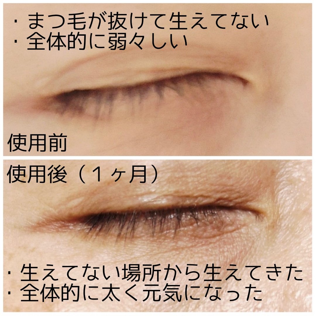 エターナルアイラッシュ/リュバンブラン/まつげ美容液を使ったクチコミ（3枚目）
