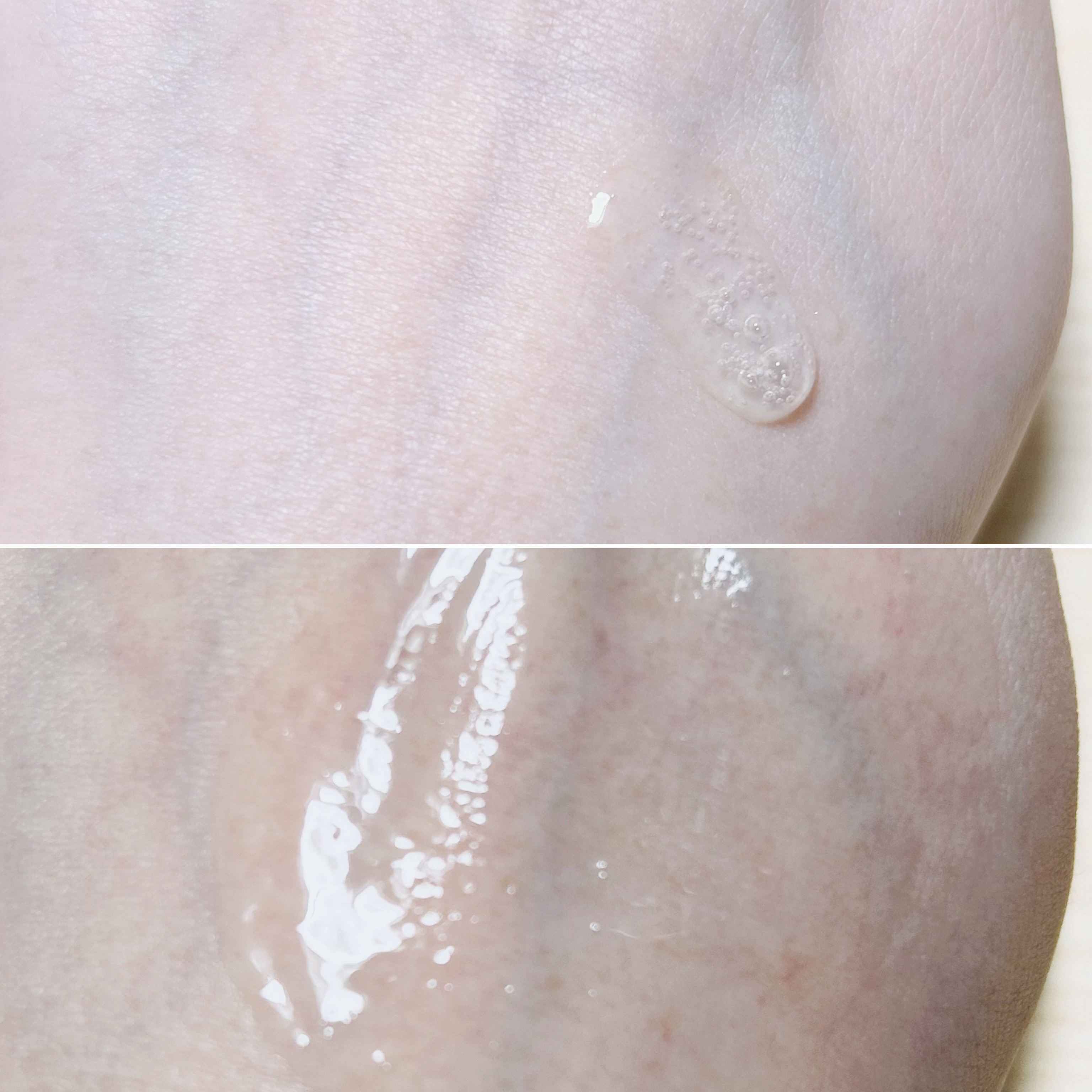 iYON インバススキンケア 美容液/iYON/美容液を使ったクチコミ（2枚目）