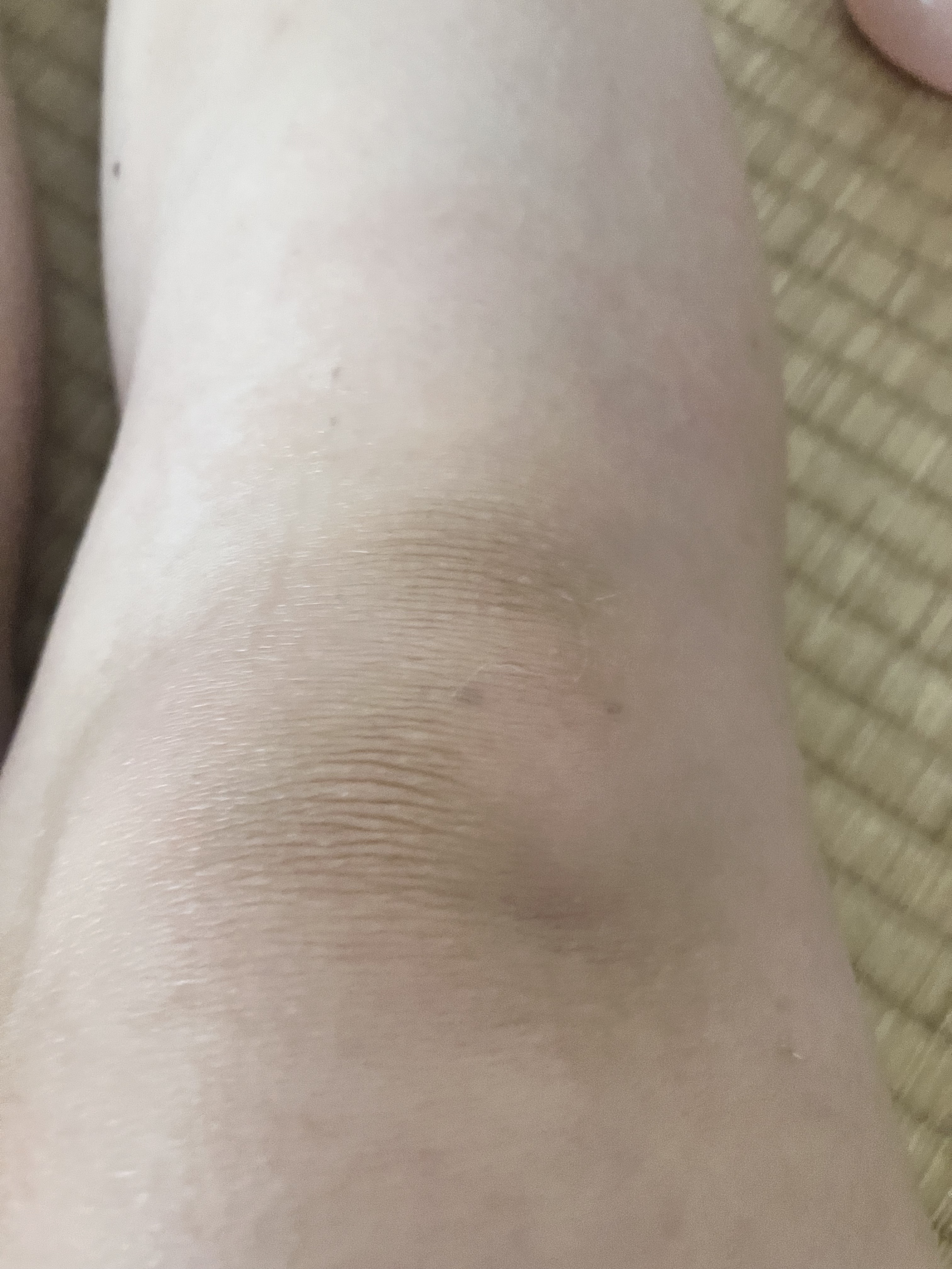 トリプル レチノール ウォッシュピール/Celladix/ピーリングを使ったクチコミ（2枚目）