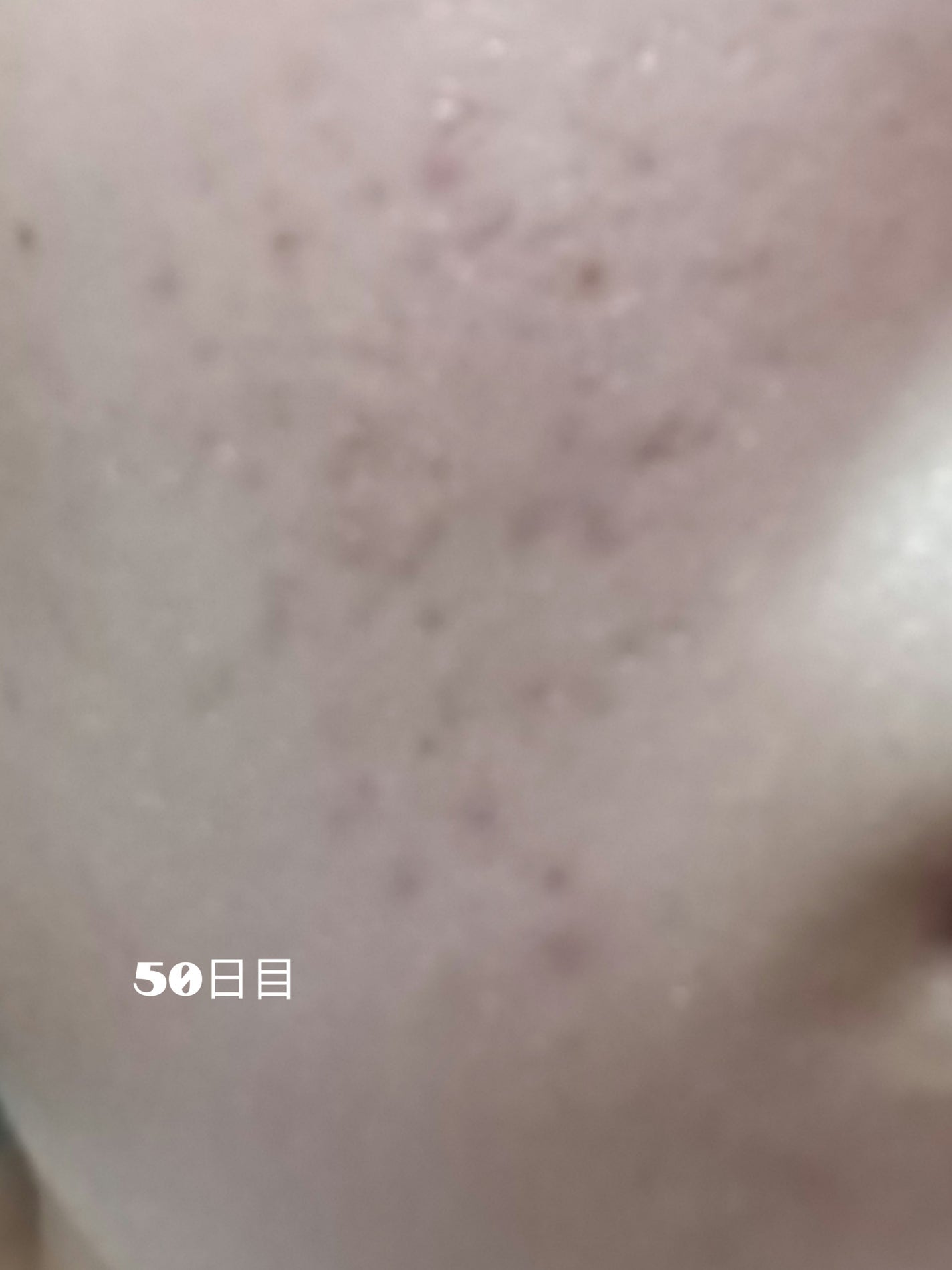 いぬ✢フォロバ100✢ on LIPS 「自分用記録デュアック50日目ついに50日経過しました!あまり大..」(1枚目)