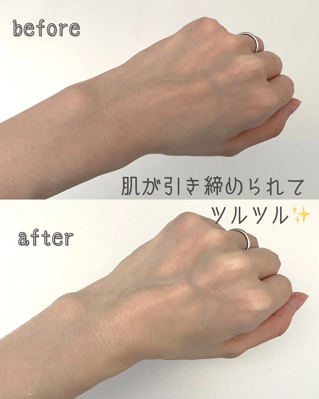 センテラ クイックカーミングパッド/SKIN1004/トナーパッドを使ったクチコミ（3枚目）