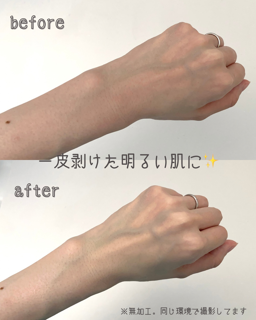 ルルルン ハイドラ V マスク/ルルルン/シートマスク・パックを使ったクチコミ（3枚目）