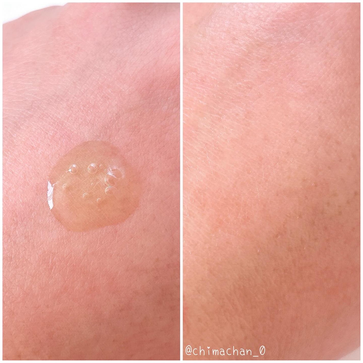 リデンス グレープポアゼロアンプル/redence/美容液を使ったクチコミ(3枚目)