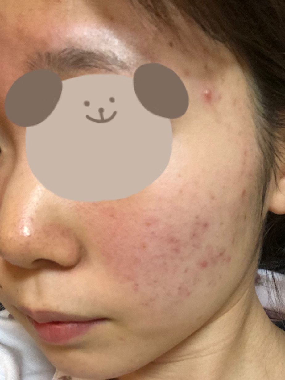 を使ったクチコミ（3枚目）