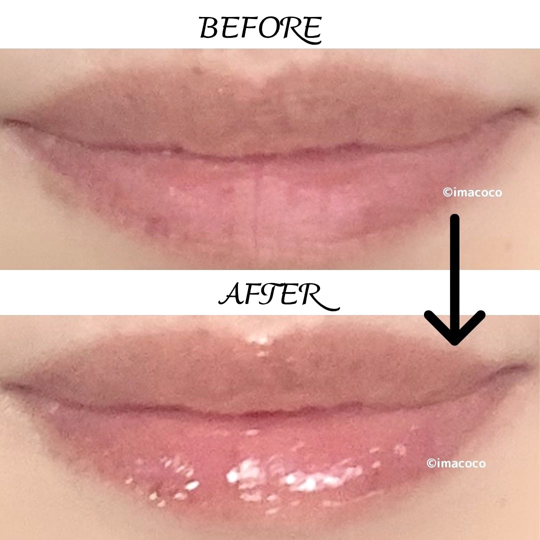 ダーマパワーX リップエッセンス/オバジ/リップ美容液を使ったクチコミ（2枚目）