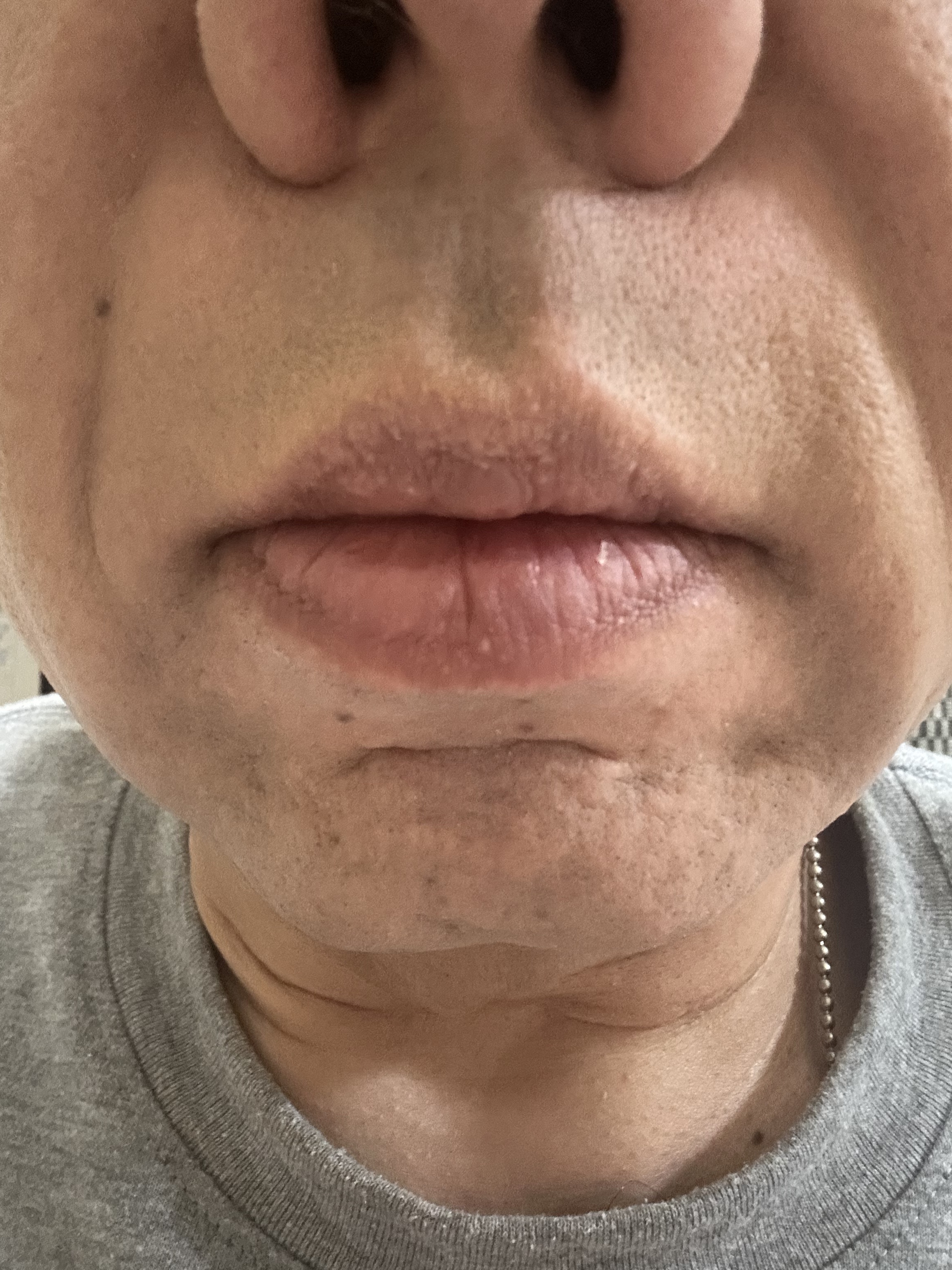 リップコンフォートオイル/CLARINS/リップグロスを使ったクチコミ（2枚目）