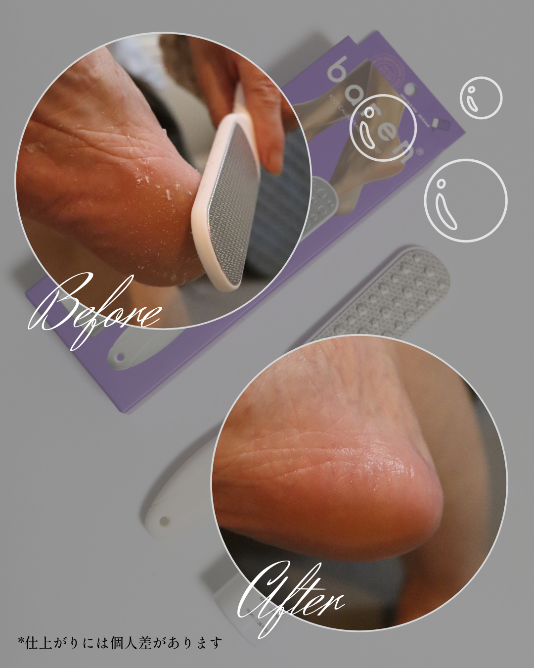 フットケアセット/BAREN/その他キットセットを使ったクチコミ(2枚目)