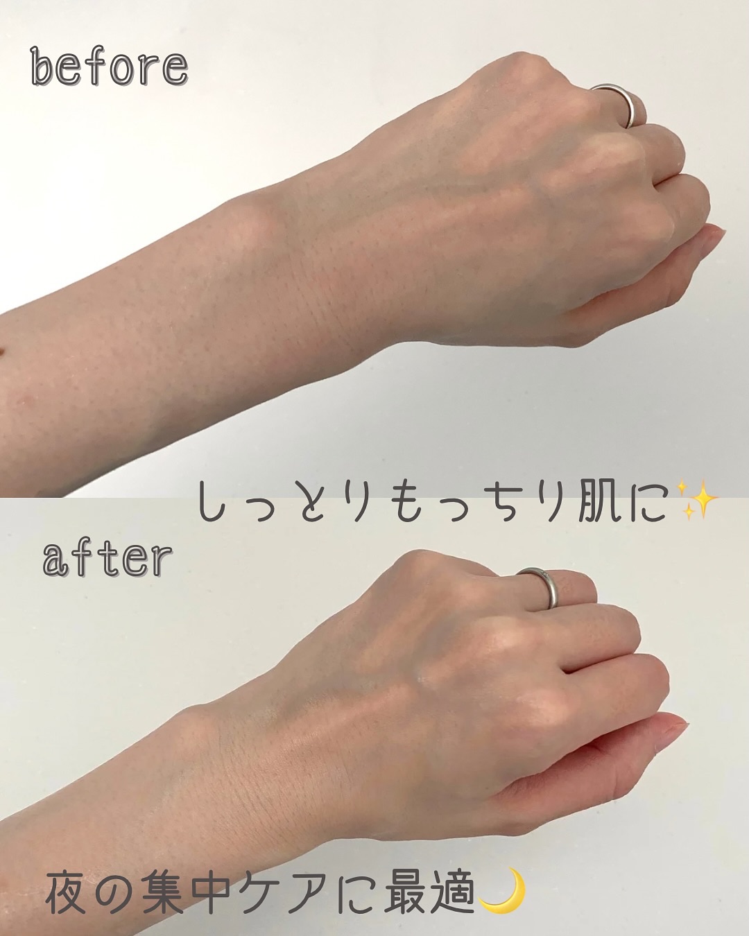 ルルルン ハイドラ EX マスク/ルルルン/シートマスク・パックを使ったクチコミ（3枚目）