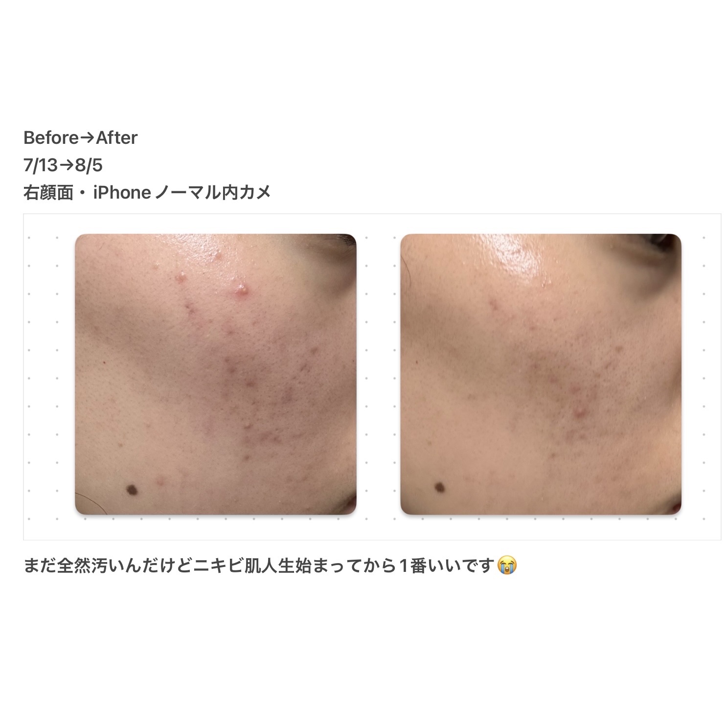 薬用ローション（とてもしっとり）/IHADA/化粧水を使ったクチコミ（2枚目）