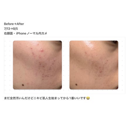 薬用ローション(とてもしっとり)/IHADA/化粧水を使ったクチコミ(2枚目)