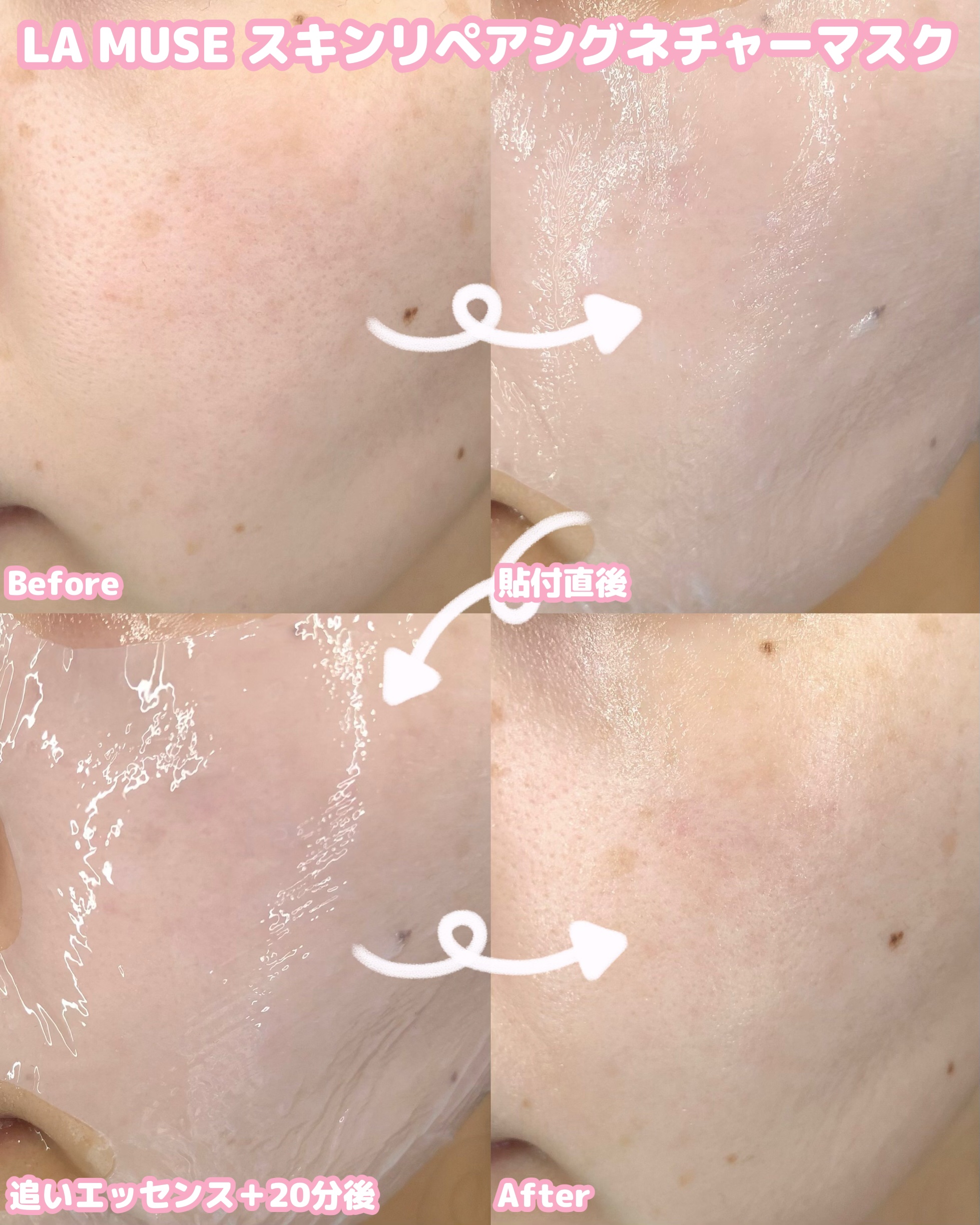 スキンリペアシグネチャーマスク/ラミューズ/シートマスク・パックを使ったクチコミ（3枚目）