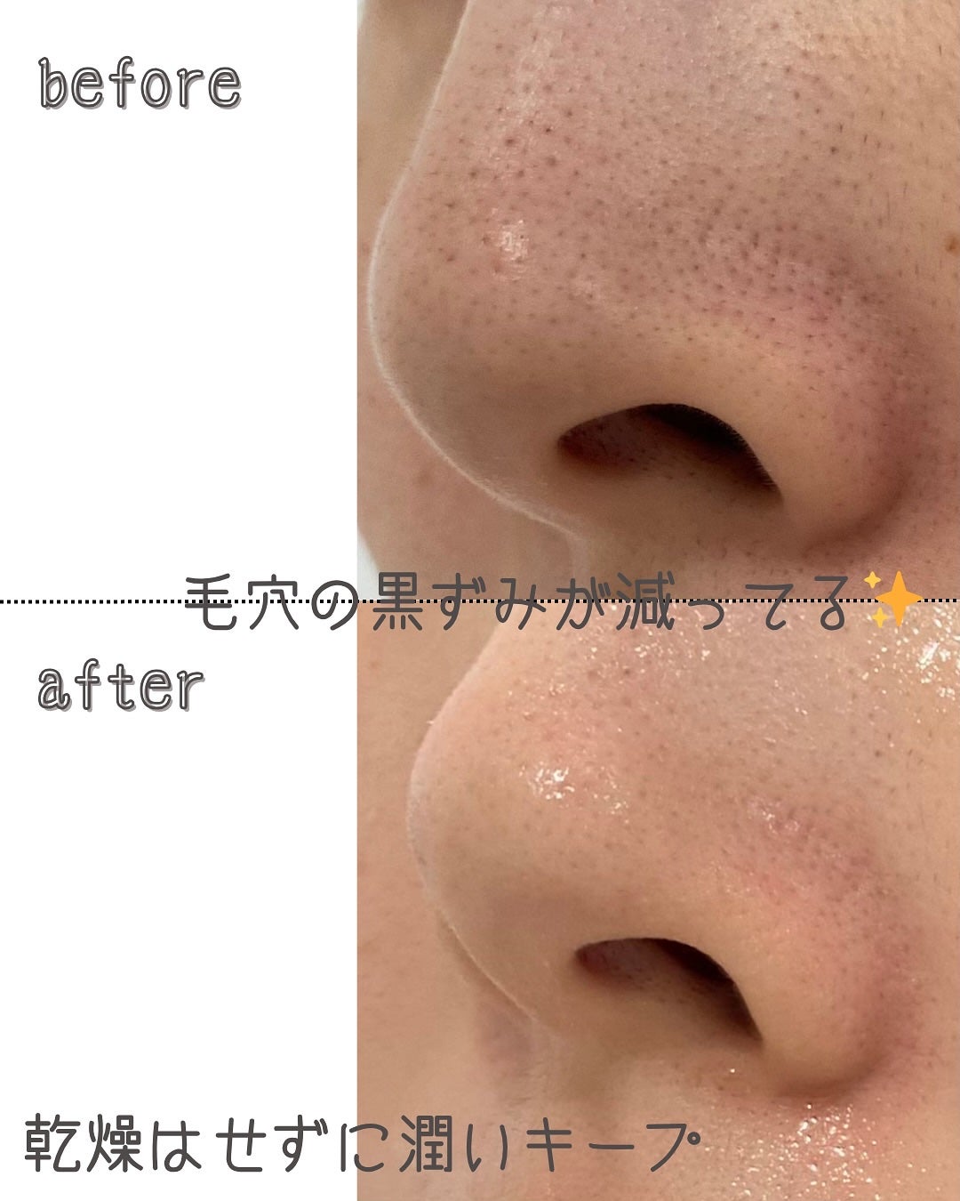 クリーンリセット スキントーニング バブルマスク/ByUR/洗い流すパック・マスクを使ったクチコミ(3枚目)