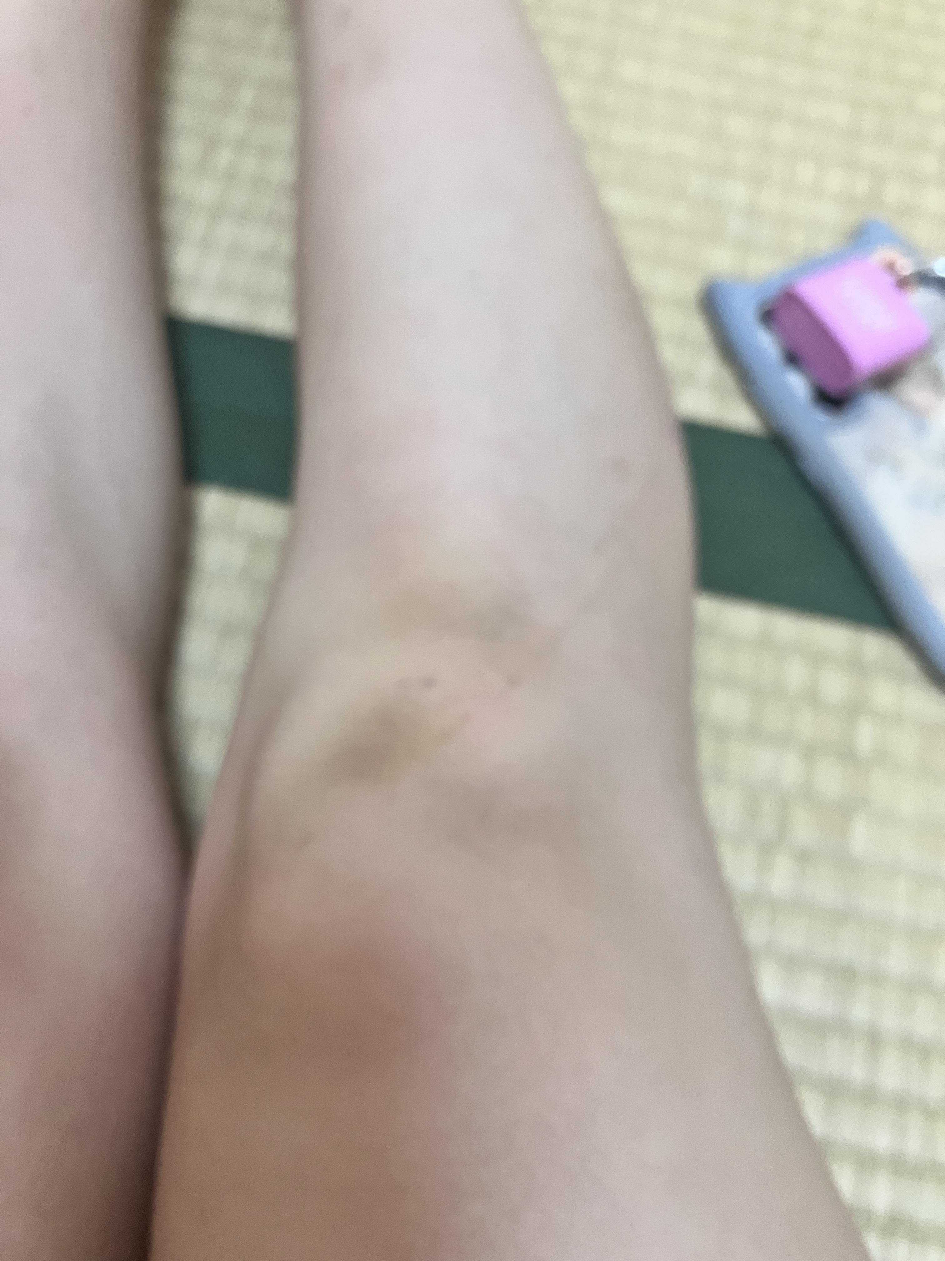 クリアバブルローション セラミド/aqua bank/化粧水を使ったクチコミ（1枚目）