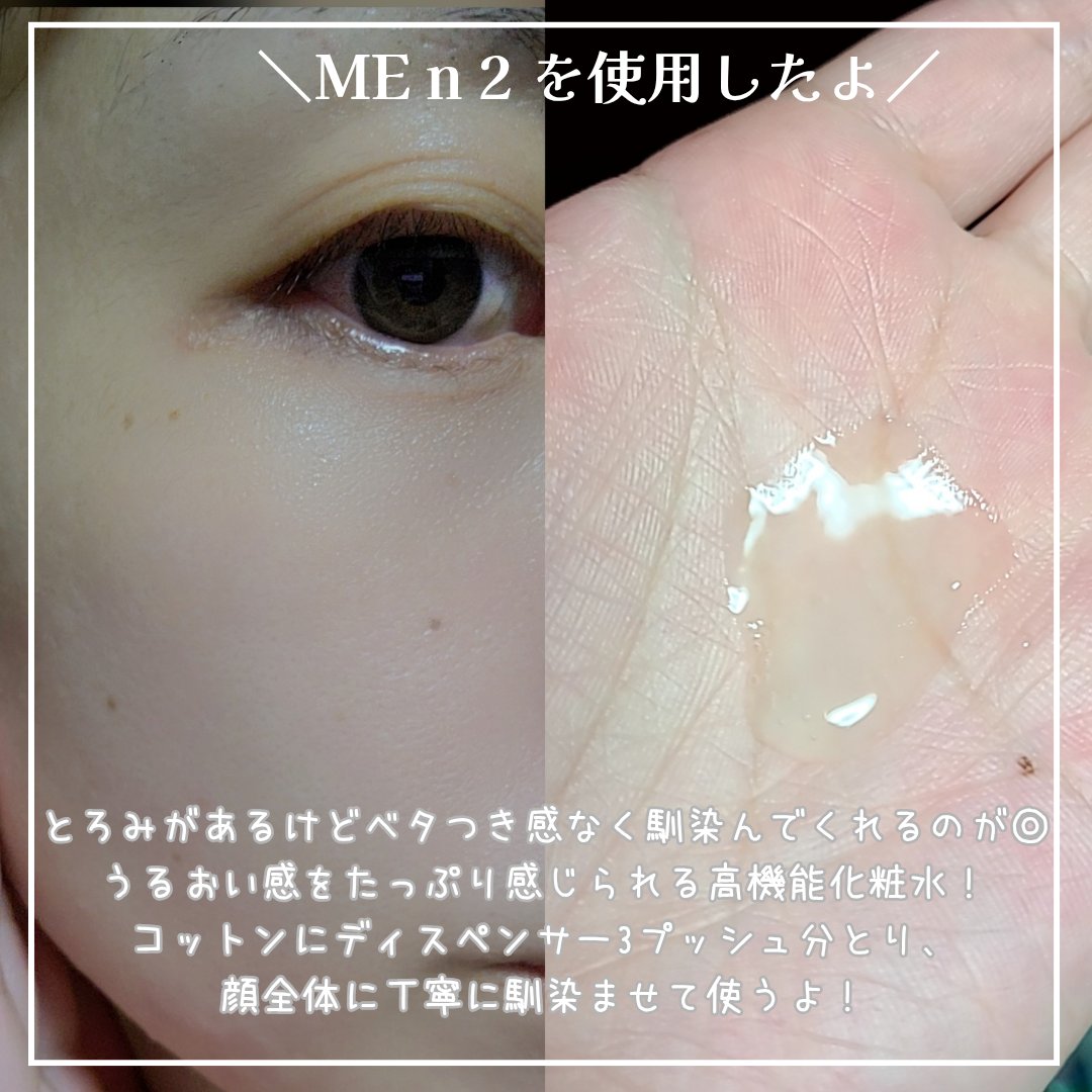 イプサ ＭＥ ｎ 2 レフィル/IPSA/化粧水を使ったクチコミ（2枚目）