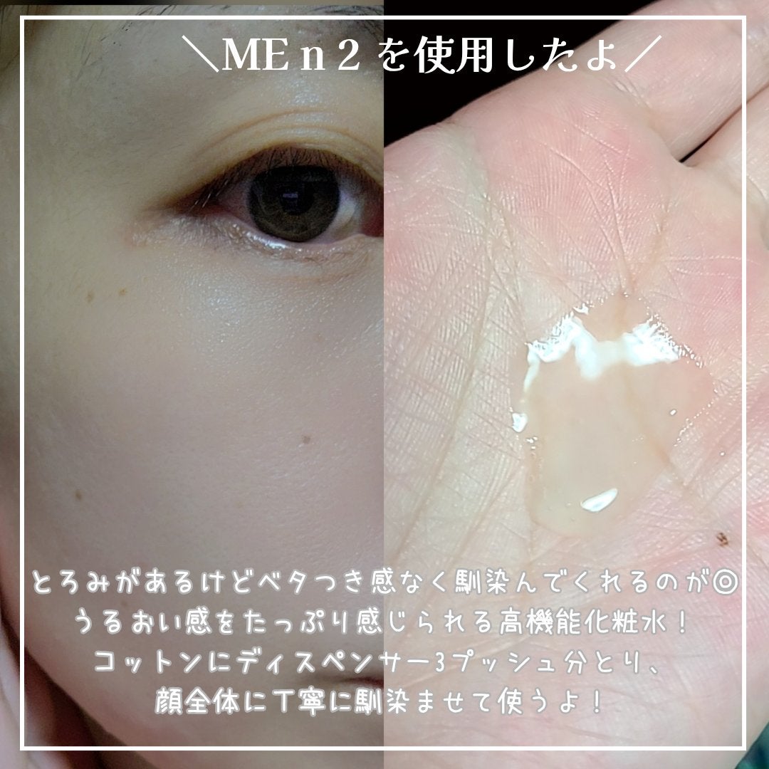 イプサ ME n 2/IPSA/化粧水を使ったクチコミ(2枚目)
