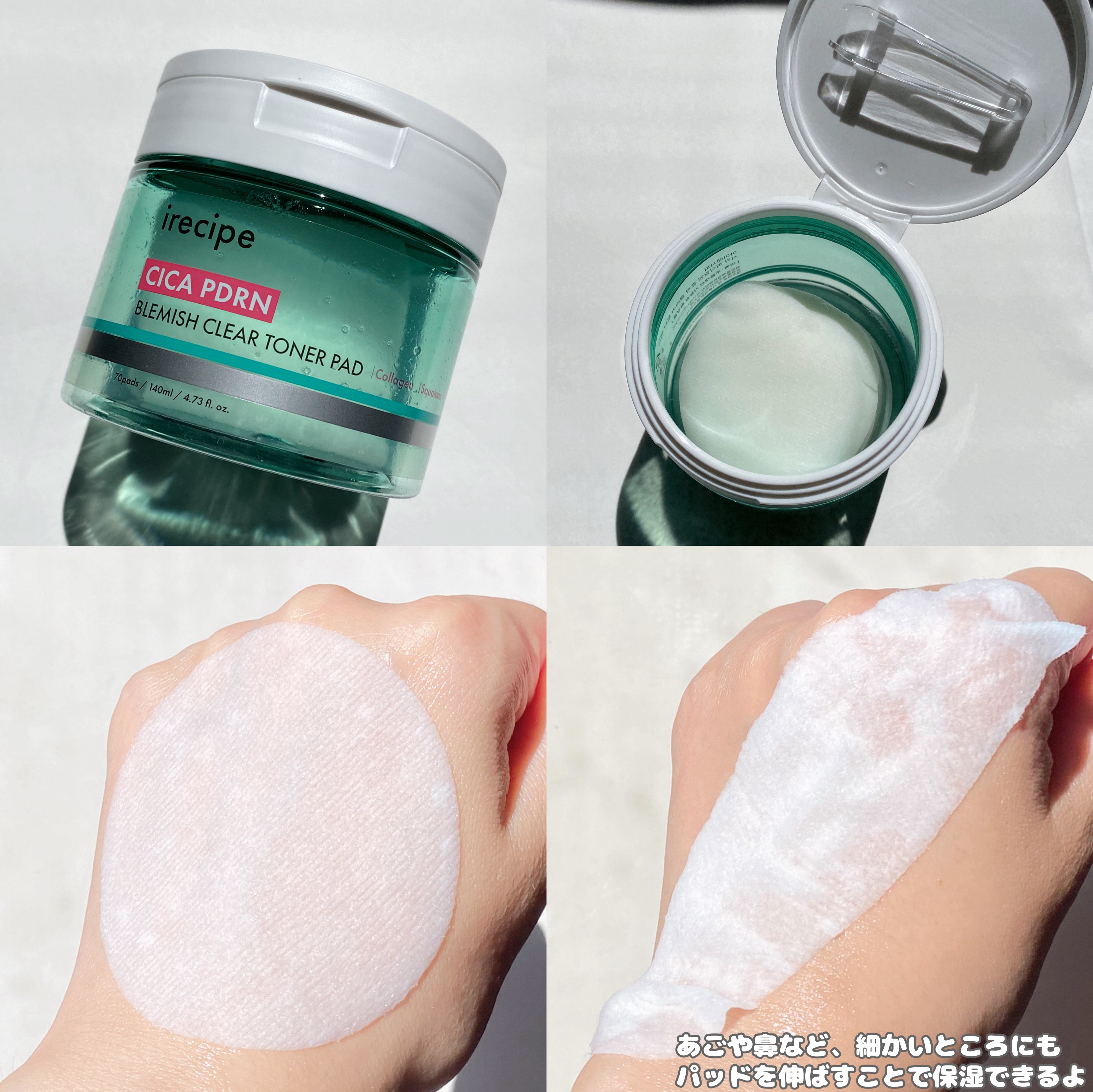 シカ PDRN 跡 クリアー トナーパッド/irecipe/トナーパッドを使ったクチコミ（2枚目）