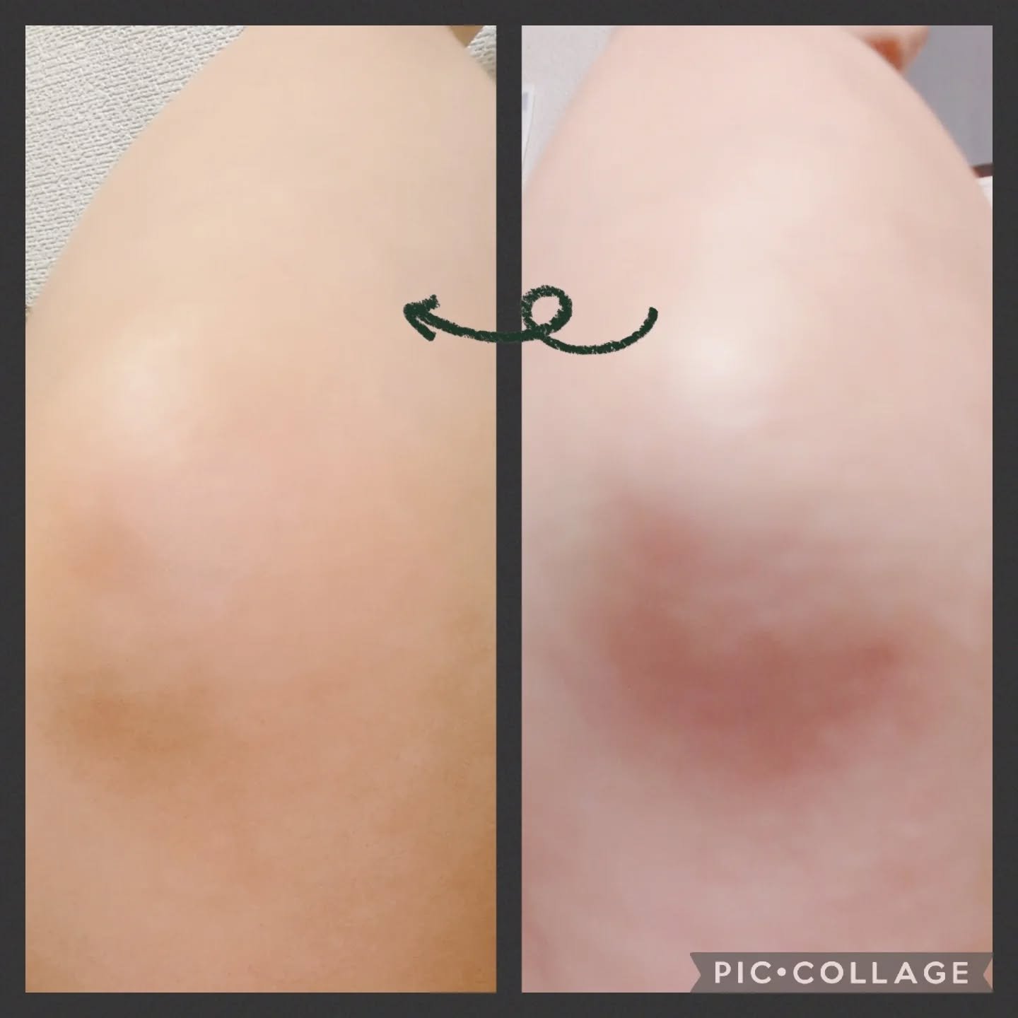 BnD マシュマロ コラーゲン AHA スクラブ /BnD/ボディスクラブを使ったクチコミ（3枚目）