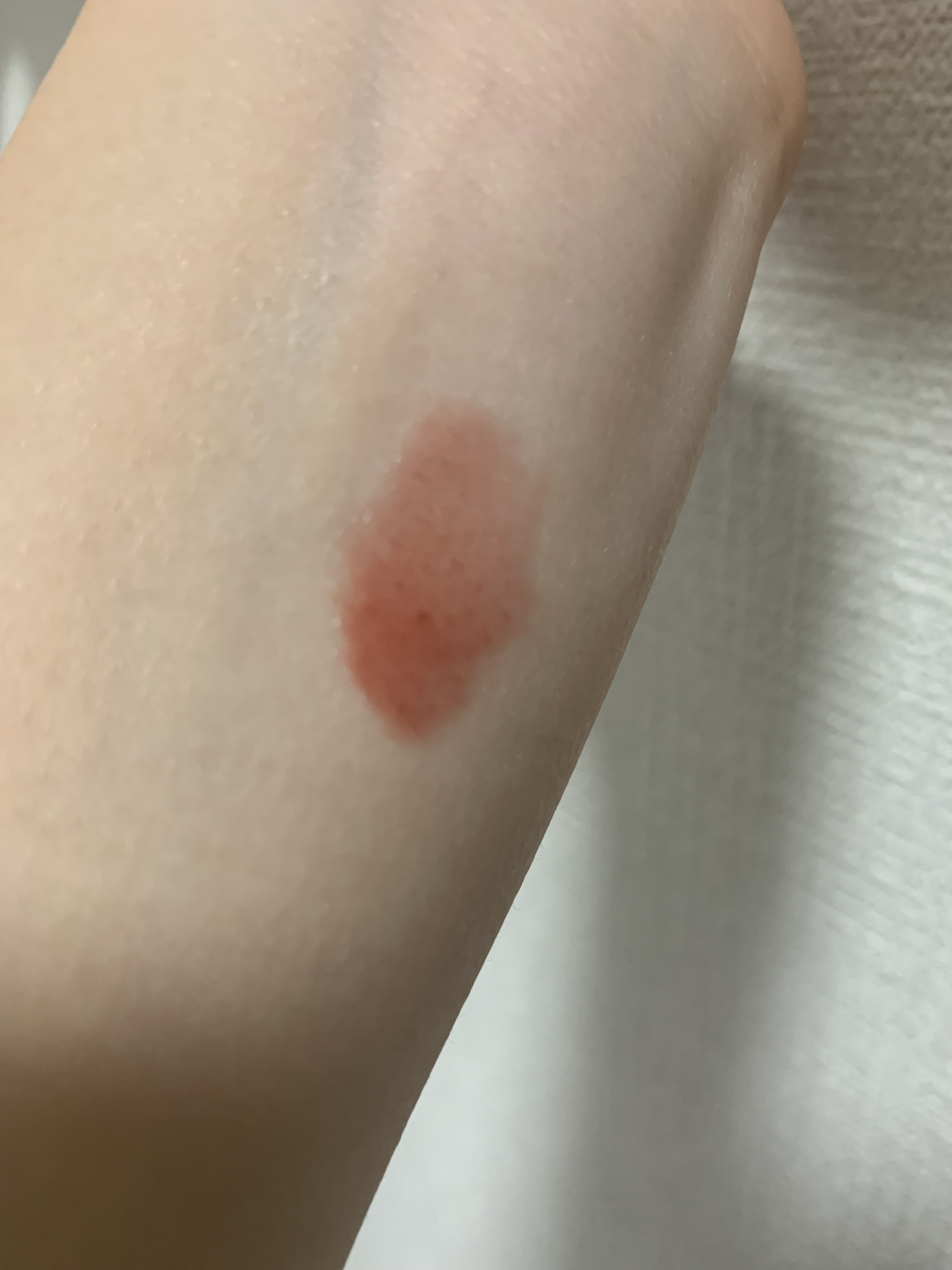 ディオール アディクト リップ マキシマイザー/Dior/リップグロスを使ったクチコミ（2枚目）