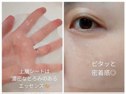 デュイセル プライベートケアマスク/DEWYCEL/シートマスク・パックを使ったクチコミ(5枚目)