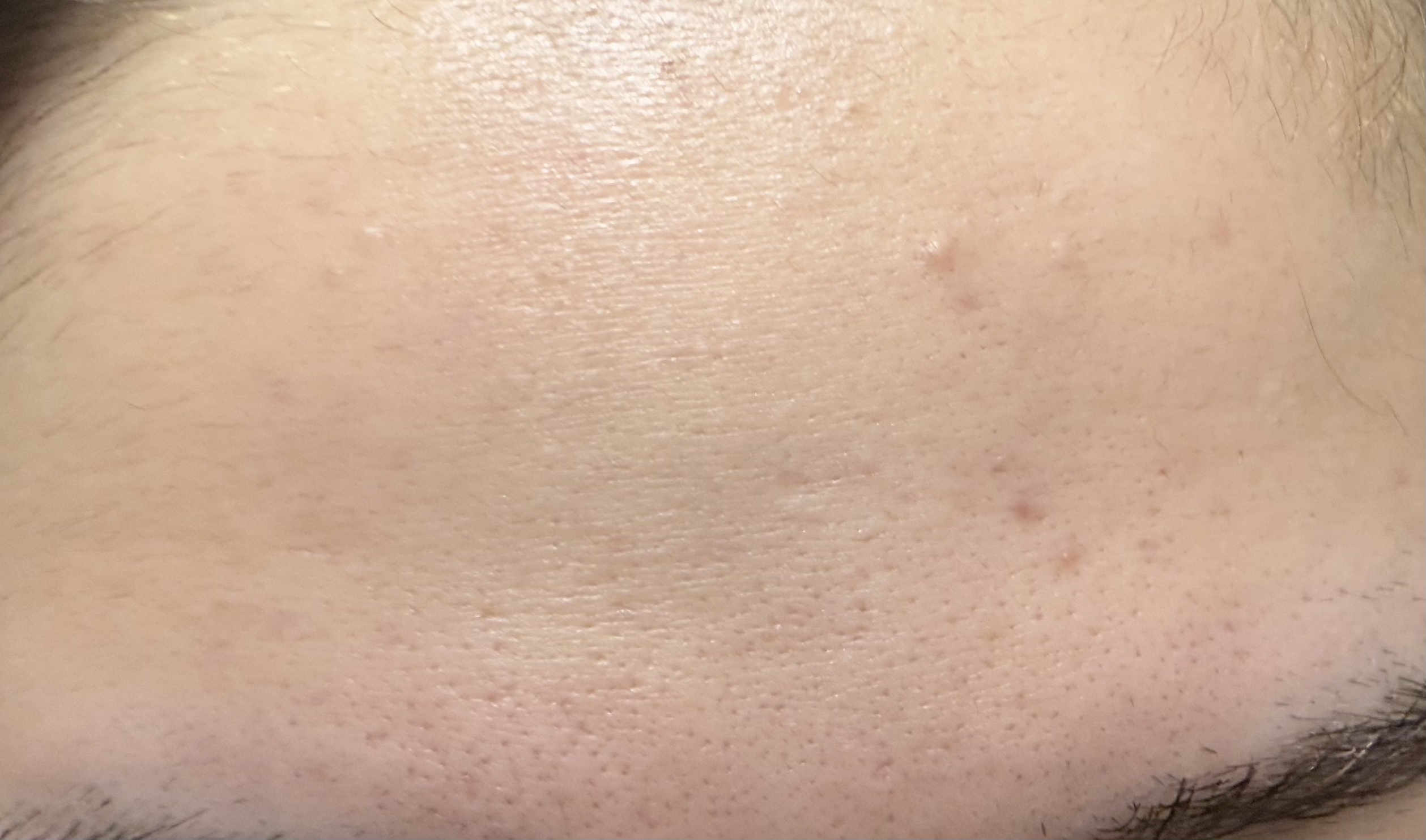 潤浸保湿 化粧水 III とてもしっとり/キュレル/化粧水を使ったクチコミ（1枚目）