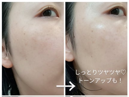 デュイセル プライベートケアマスク/DEWYCEL/シートマスク・パックを使ったクチコミ(8枚目)