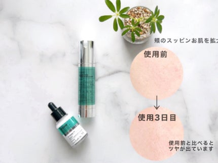 PDRN+リードルS 100/VT/美容液を使ったクチコミ(4枚目)