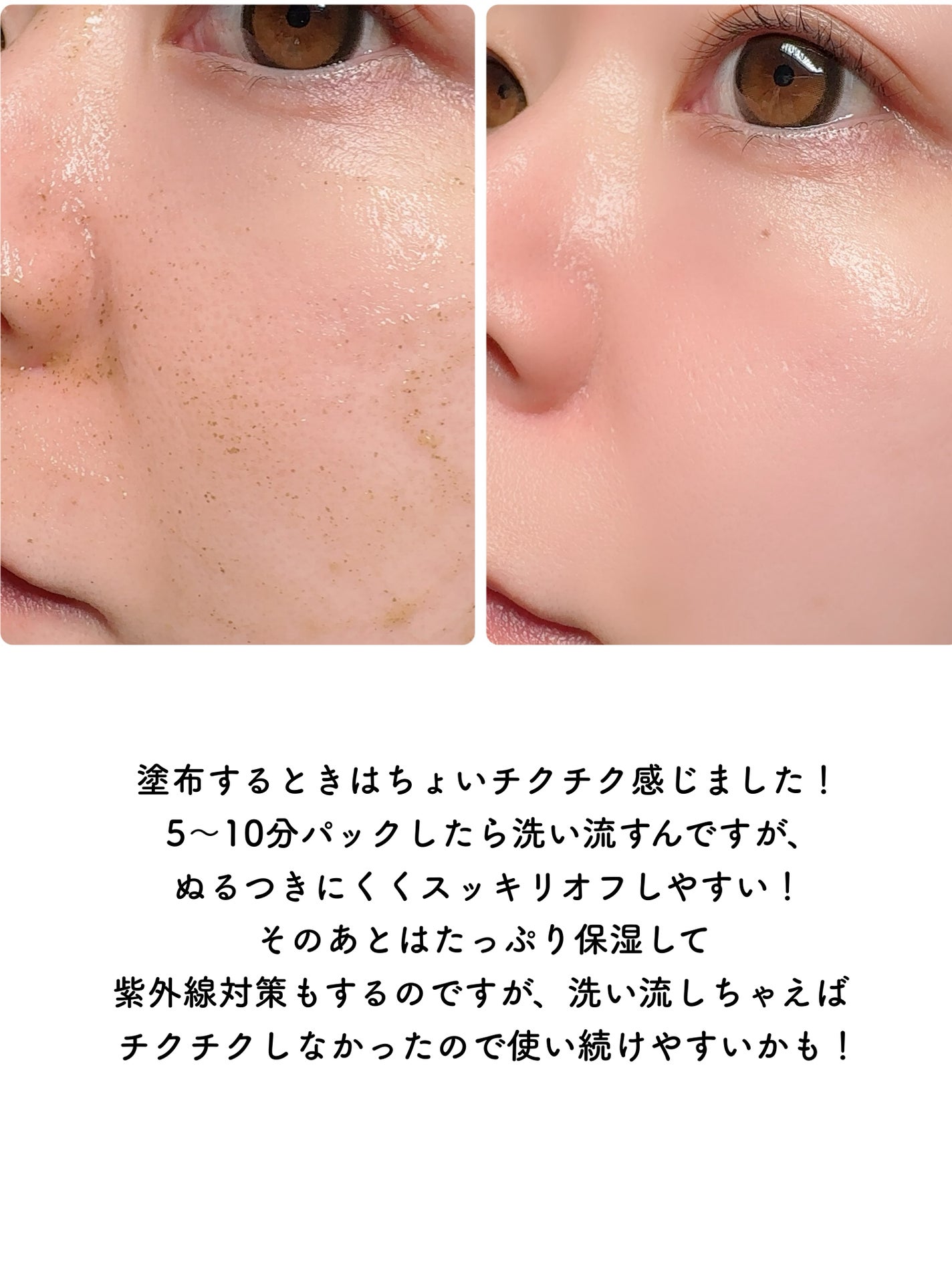 ハーブピーリング/on:myskin/ピーリングを使ったクチコミ(5枚目)