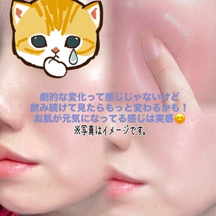 コラーゲンフォースキン/iHEAL/美容サプリメントを使ったクチコミ(5枚目)