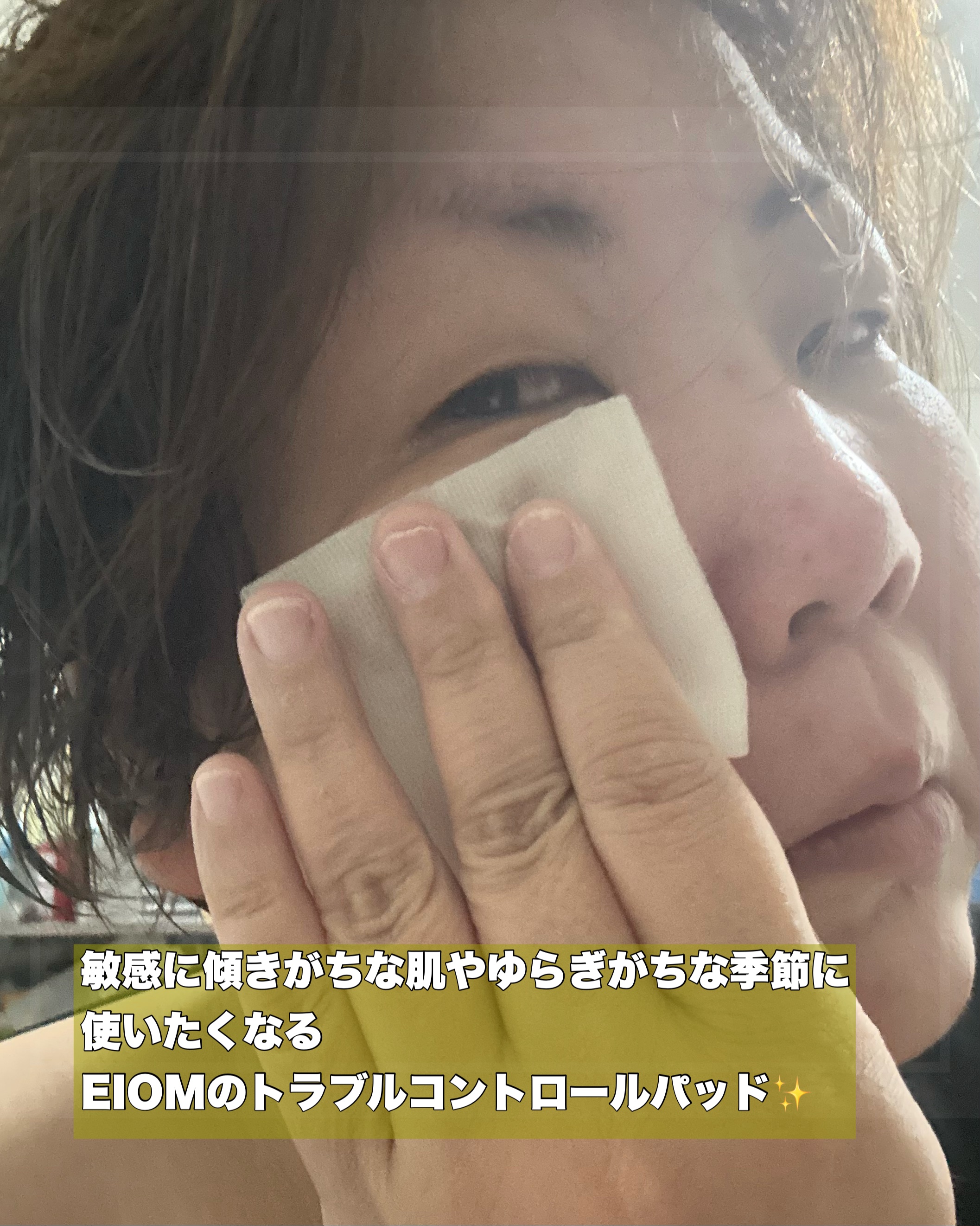 トラブルコントロールパッド/EIOM/トナーパッドを使ったクチコミ（2枚目）