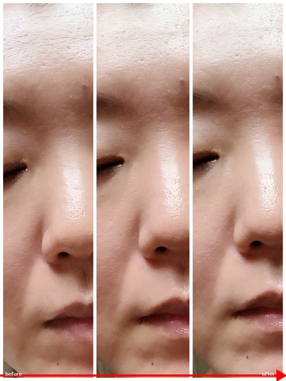 バナナ PDRN 2X セラム/Celladix/美容液を使ったクチコミ（3枚目）