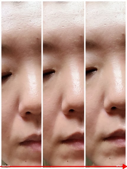 バナナ PDRN 2X セラム/Celladix/美容液を使ったクチコミ(3枚目)