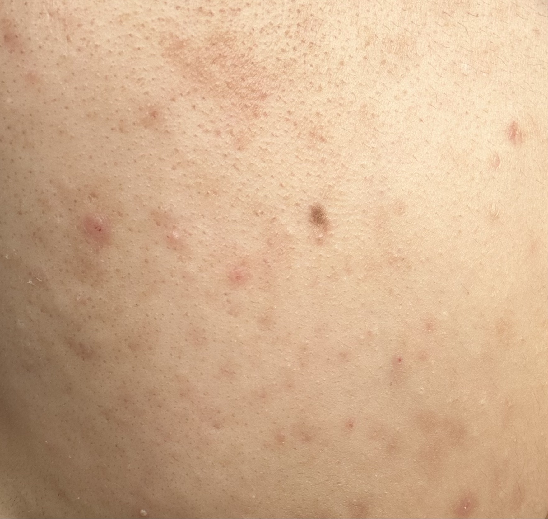 マルチアクアバーム/アクアレーベル/フェイスバームを使ったクチコミ（2枚目）