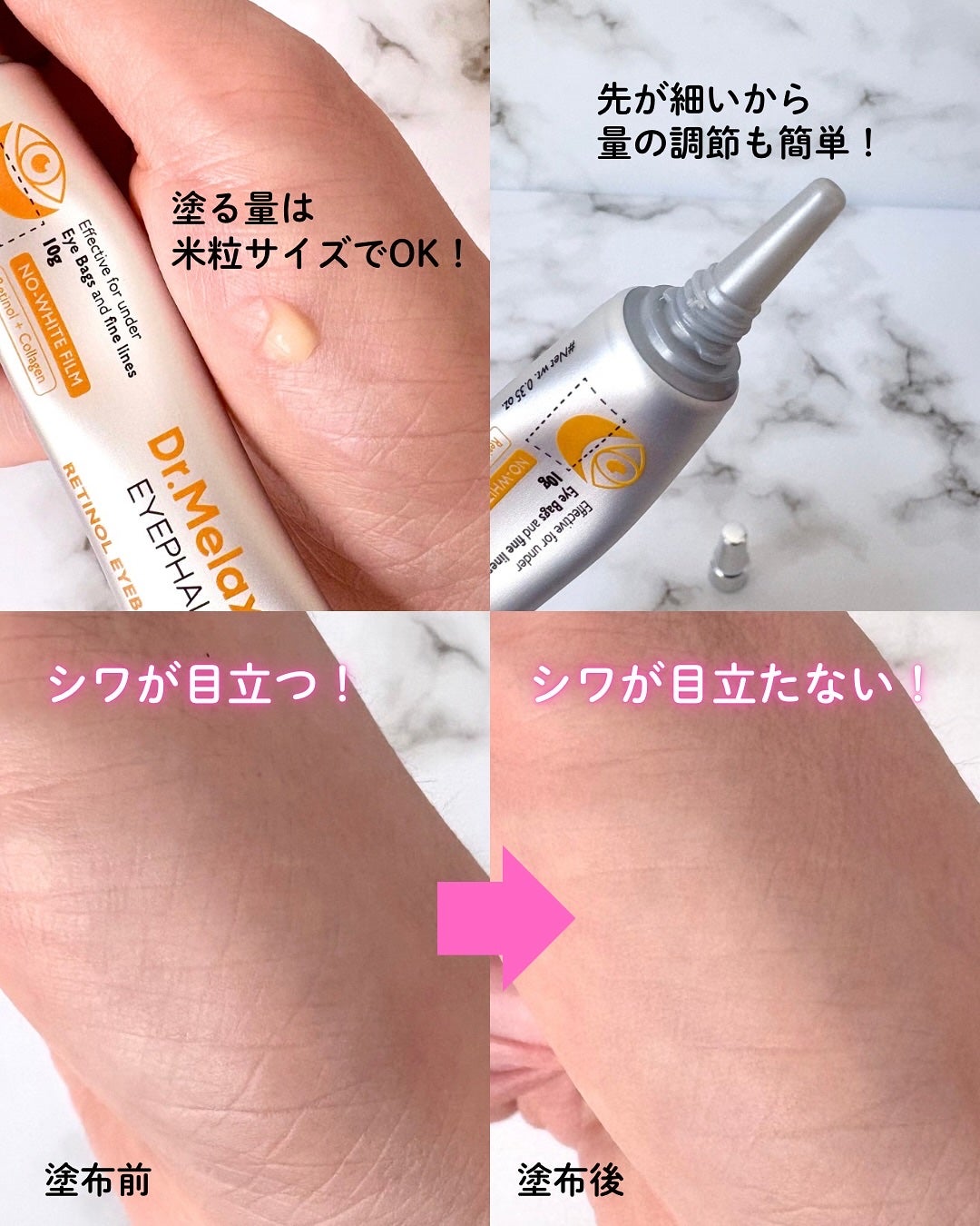 レチノールアイファルトアイバッククリーム/Dr.Melaxin/アイケア・アイクリームを使ったクチコミ(3枚目)