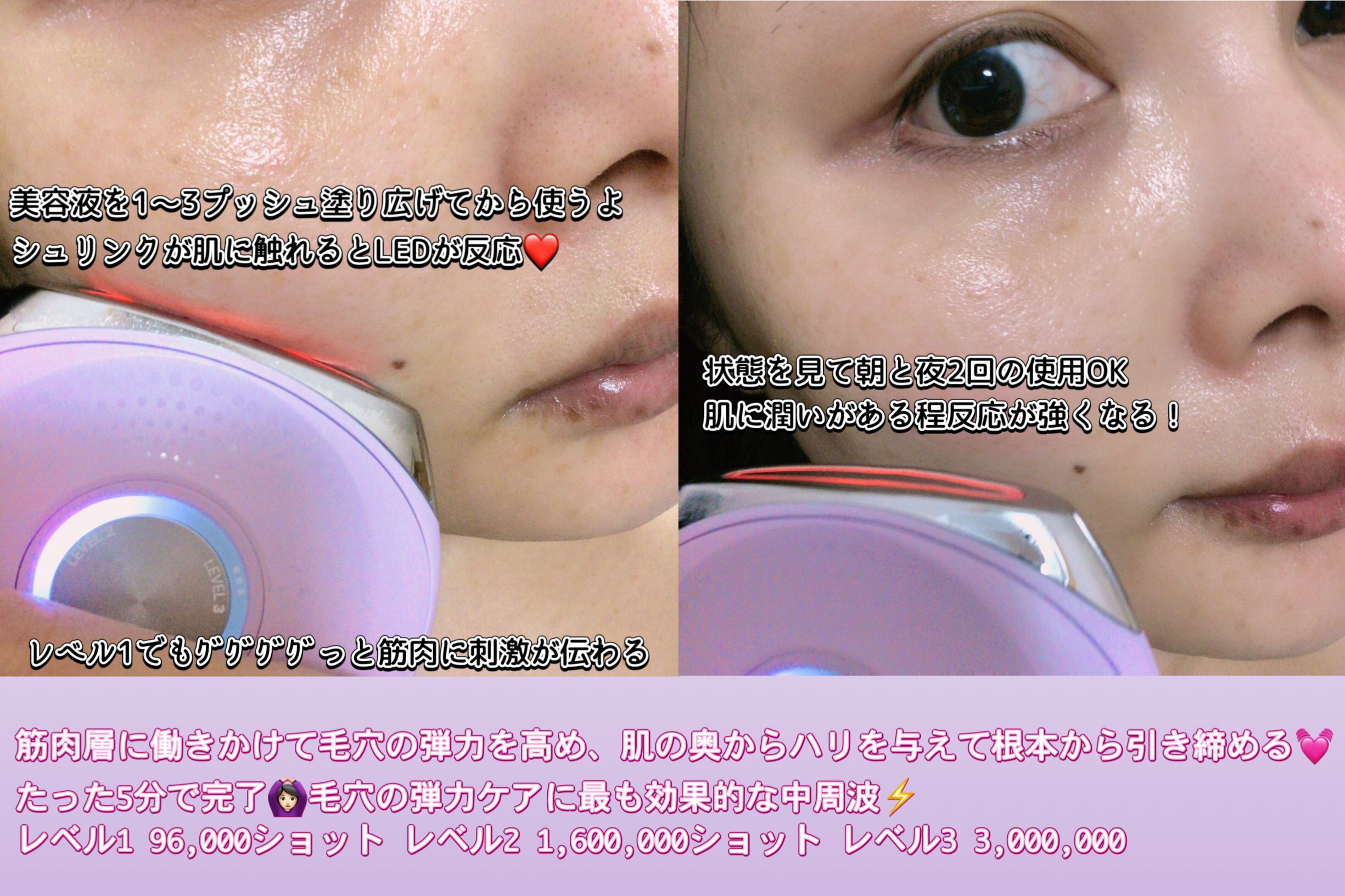 プロバイオダーム™ コラーゲンリモデリングセラム/BIOHEAL BOH/美容液を使ったクチコミ（3枚目）