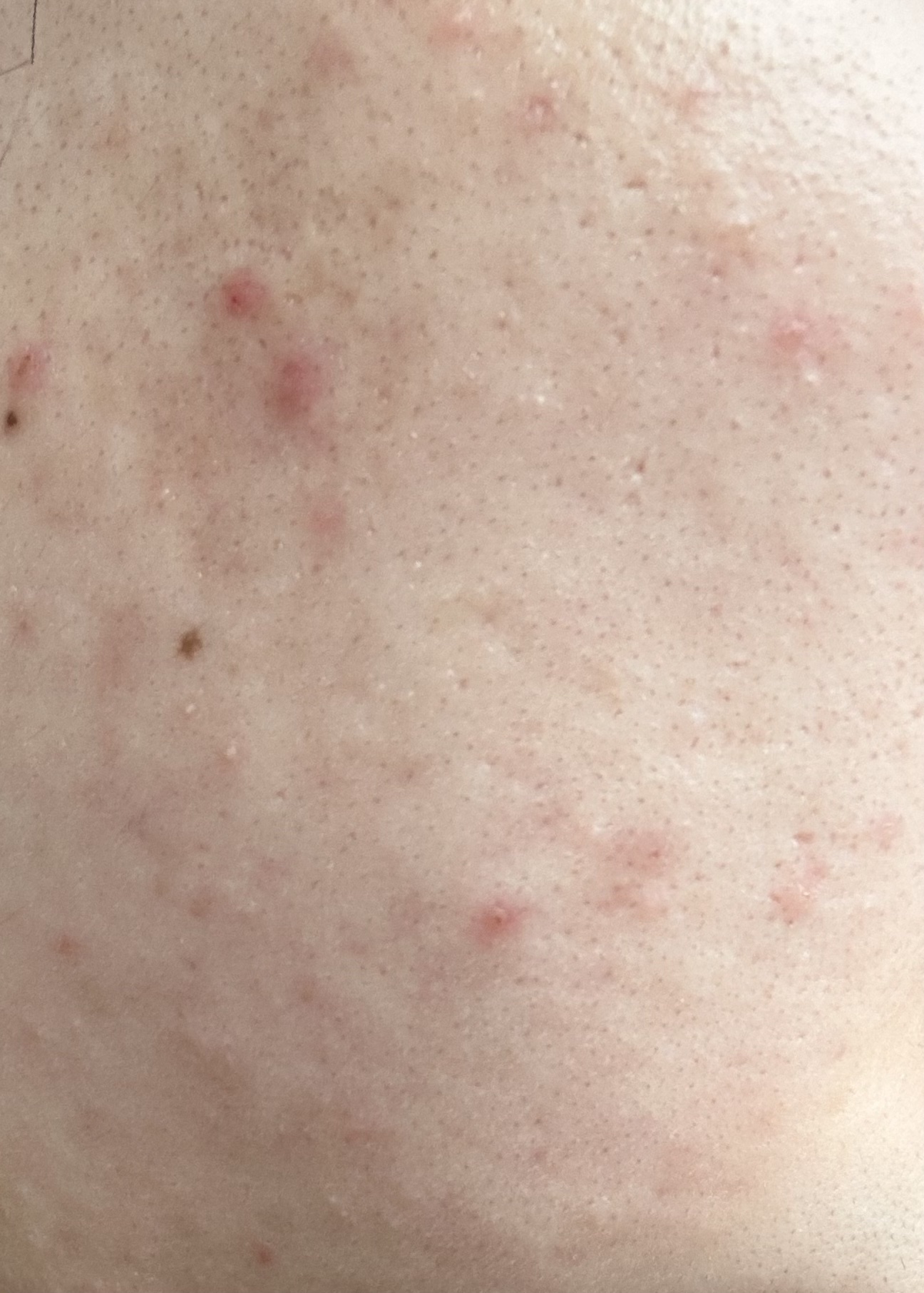 マルチアクアバーム/アクアレーベル/フェイスバームを使ったクチコミ（1枚目）